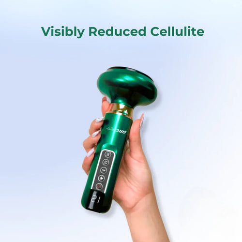 KithVane - Electric Cupping Massager
